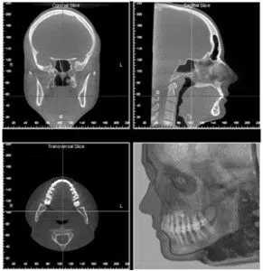 chirurgie-maxillo-faciale