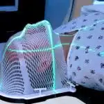 Traitement par radiothérapie de pathologies non cancéreuses