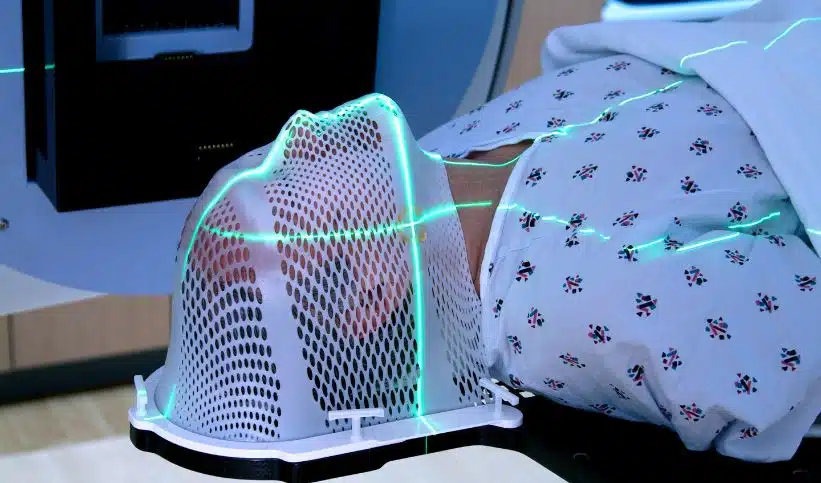 Traitement par radiothérapie de pathologies non cancéreuses